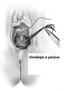 Doni te 'riktheni' virgjerine? Ja si do duket organi juaj gjenital.
