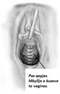 Doni te 'riktheni' virgjerine? Ja si do duket organi juaj gjenital.