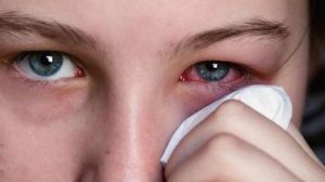 Keni dhimbje sysh? Ja ilaci natyror qe ju nevojitet. dhimbja e syve Perdorimi i ilacit
