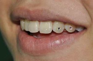 Rikthehet perseri moda e piercing. Kete here vendi perfekt eshte dhembi!!