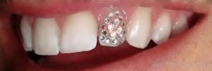 Rikthehet perseri moda e piercing. Kete here vendi perfekt eshte dhembi!!