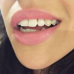 Rikthehet perseri moda e piercing. Kete here vendi perfekt eshte dhembi!!
