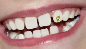 Rikthehet perseri moda e piercing. Kete here vendi perfekt eshte dhembi!!