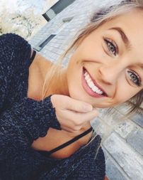 Selfie-mania dhe problemet estetike qe sjell.Rrjetet sociale ndikimi i selfieve ne shendetin estetik
