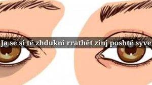 Maske natyrale qe ju ndihmon te zhdukni rrathet e zinj poshte syve. Bukuri